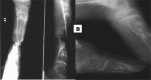 Fig. 2-B