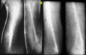 Fig. 4-B