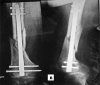Fig. 3-B