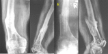 Fig. 3-E