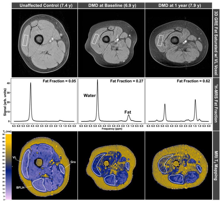 FIGURE 3