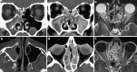 Fig. 21