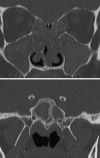 Fig. 19