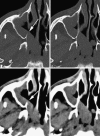 Fig. 16