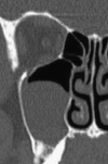Fig. 15