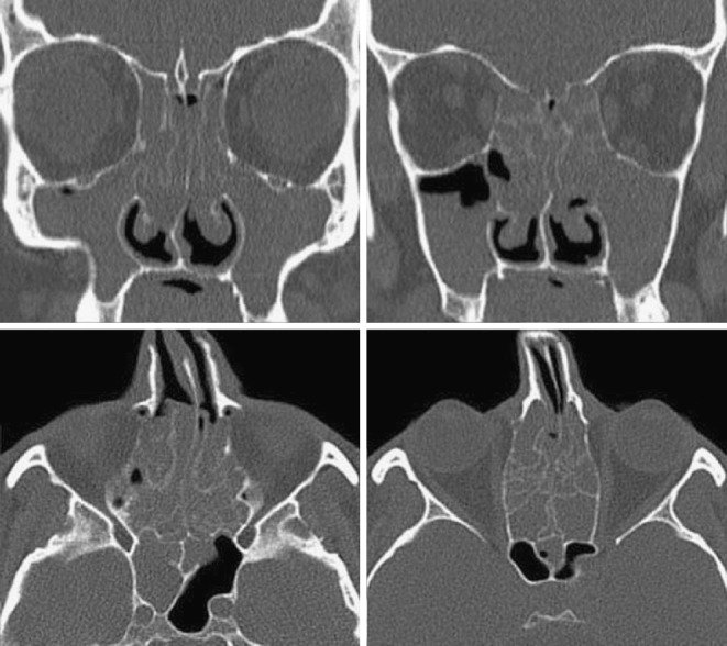 Fig. 14