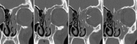Fig. 13