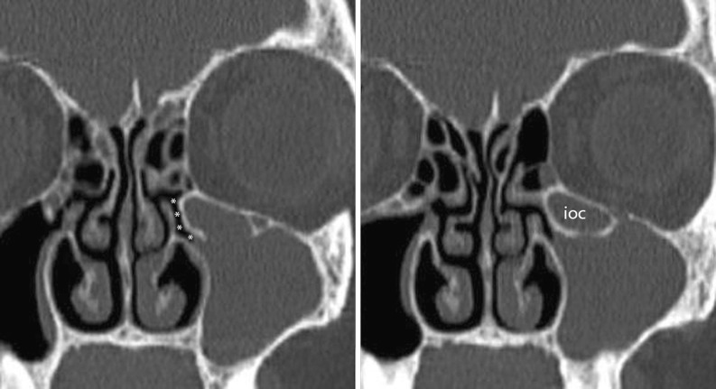 Fig. 11