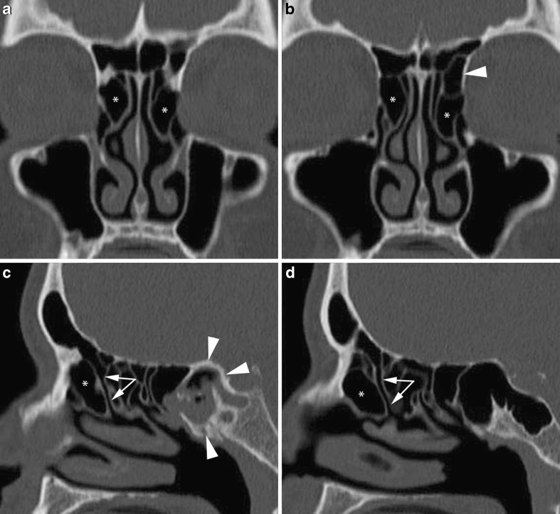 Fig. 5