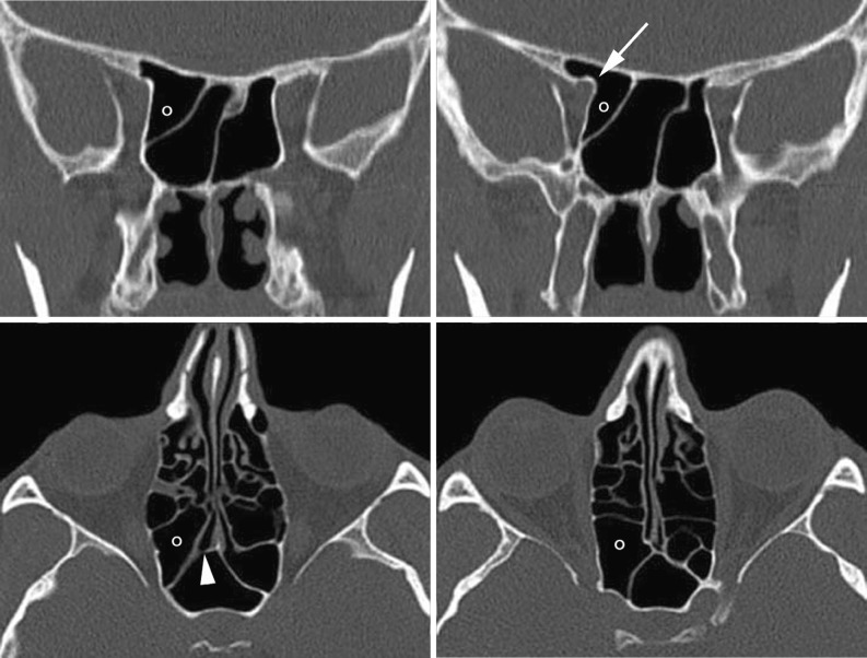 Fig. 9