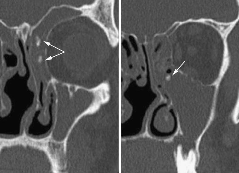 Fig. 17