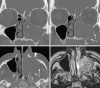 Fig. 20