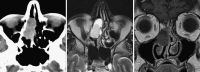 Fig. 18