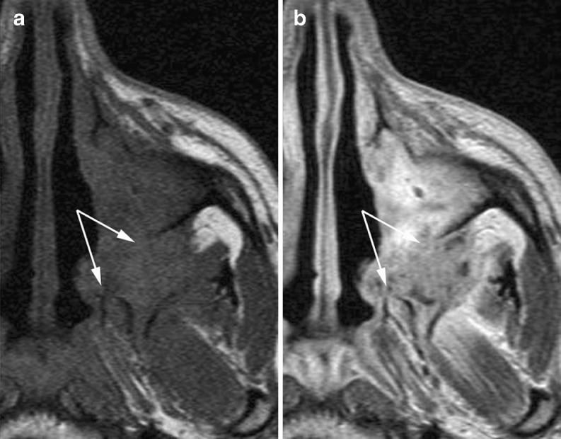 Fig. 22