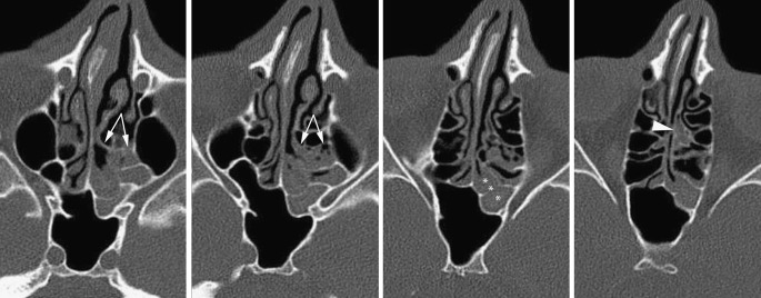 Fig. 12