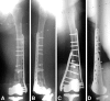 Fig. 2A–D