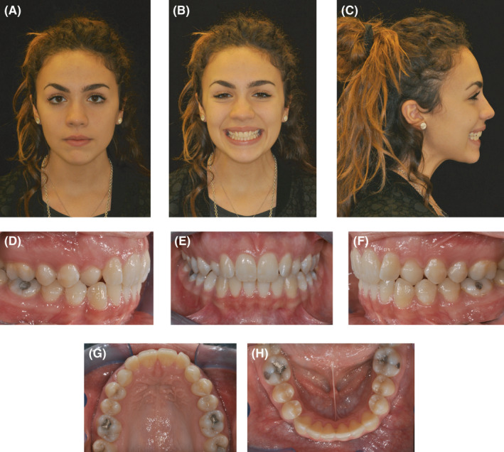 FIGURE 1