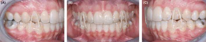 FIGURE 11