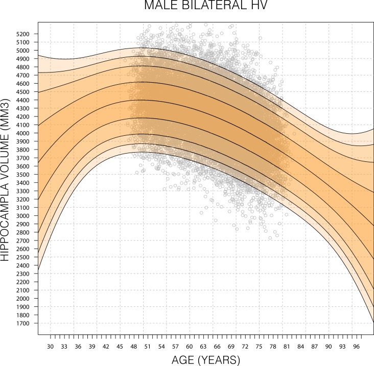 Nomograms of human hippocampal volume shifted by polygenic scores - PMC