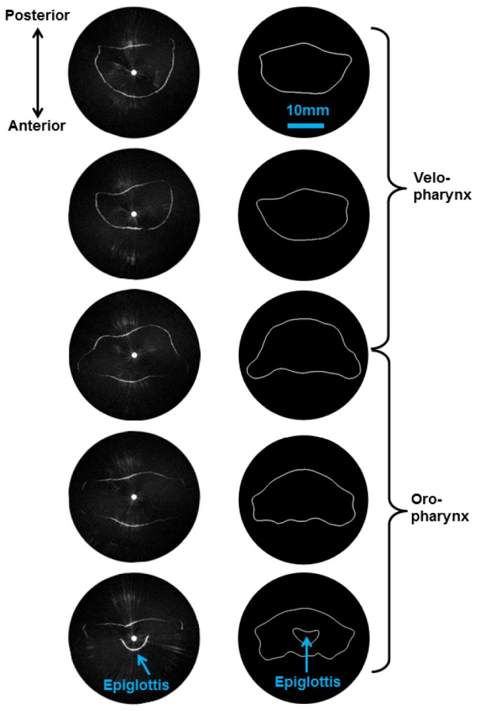 Fig. 5