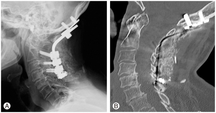 Fig. 6