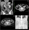 Fig. 1