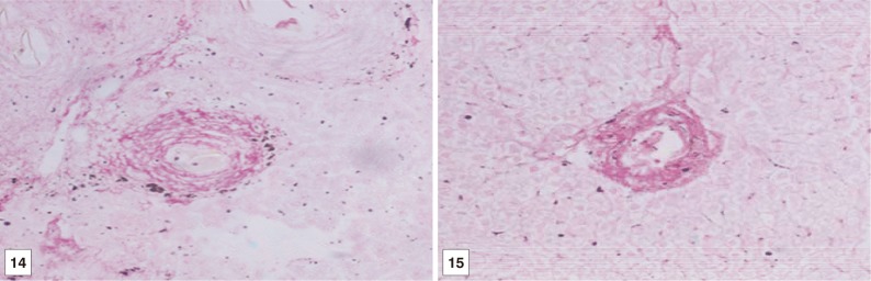 Fig. 14, 15