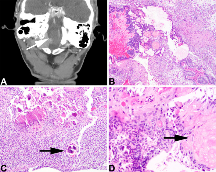 Fig. 10