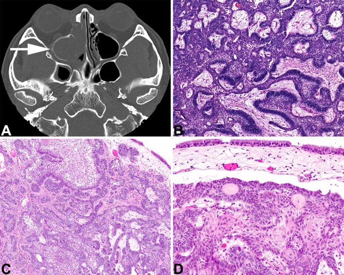 Fig. 9