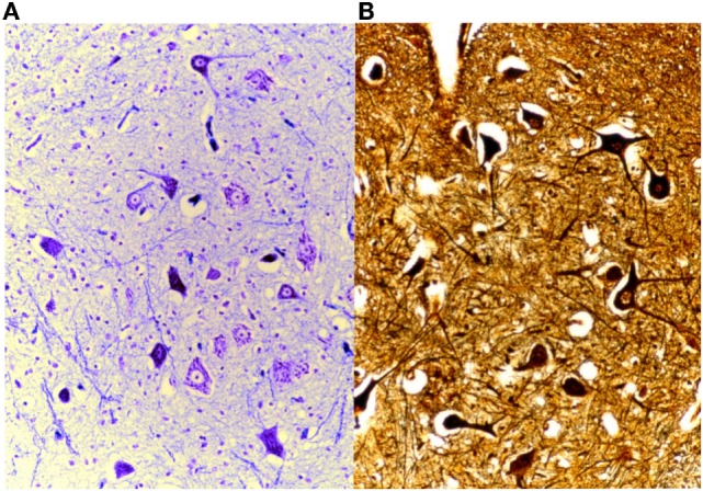 Figure 15