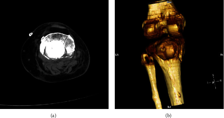 Figure 5