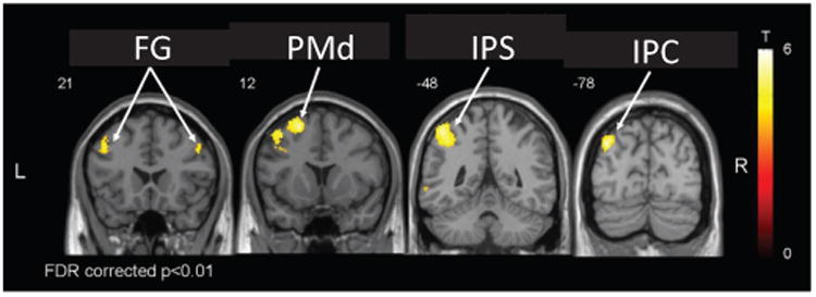 Fig. 12