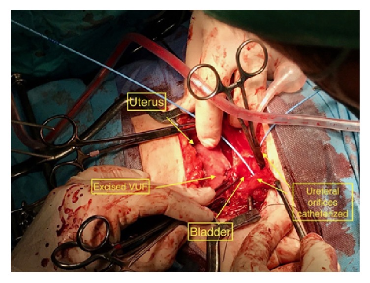 Figure 4