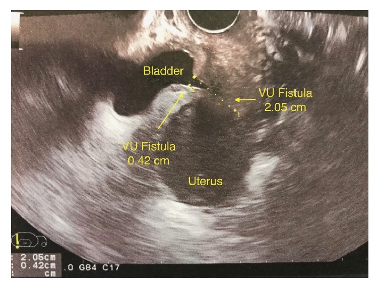 Figure 2