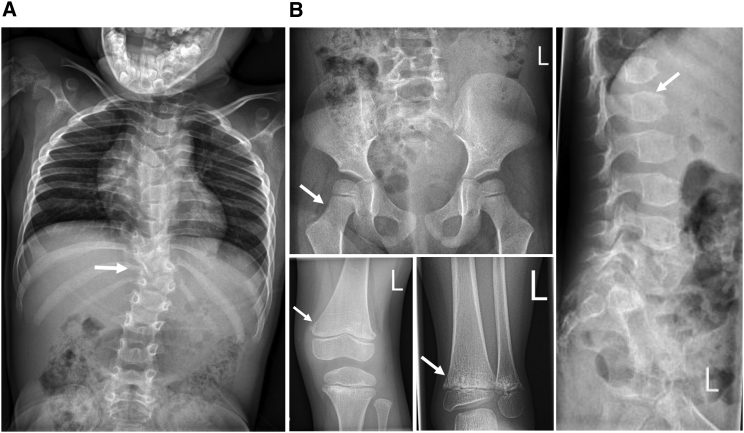 Figure 3