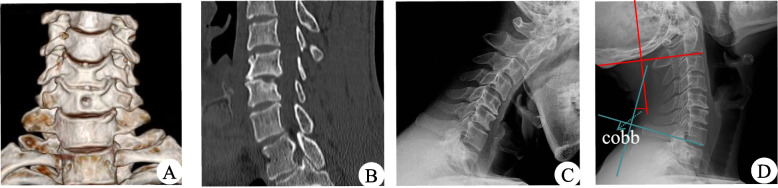 Fig. 7