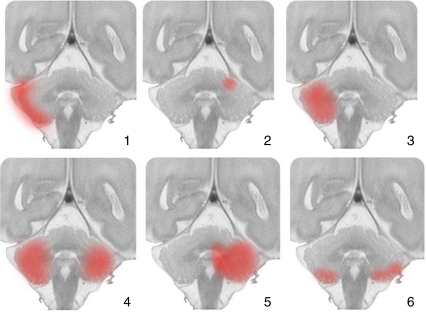 Fig. 1