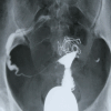 Figure 15