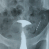 Figure 14