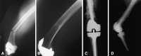 Fig. 2A–D