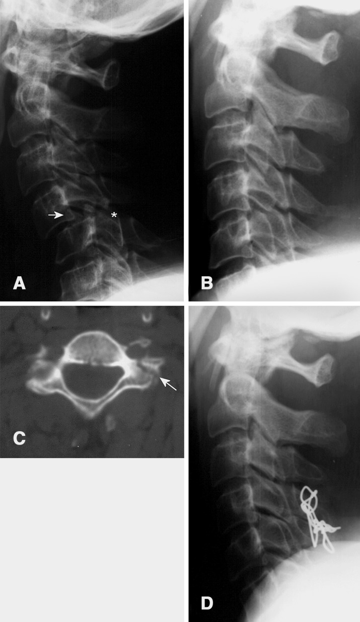 Fig. 1A–D