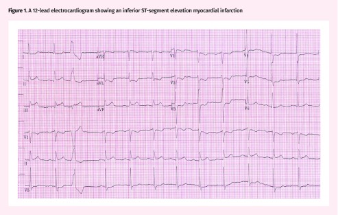 Figure 1.