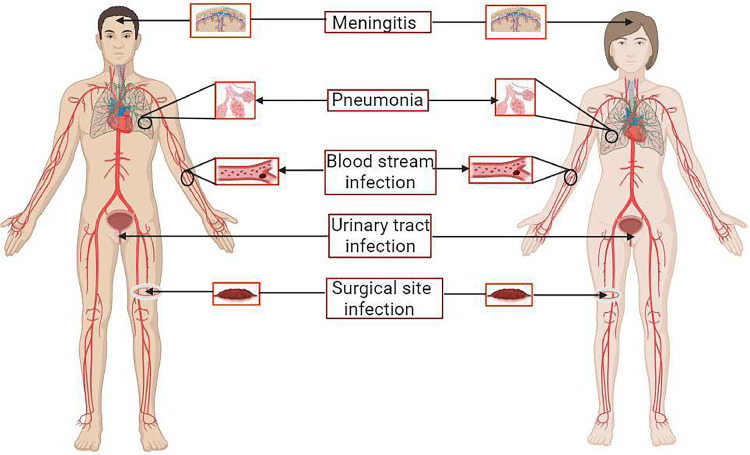 Fig 2: