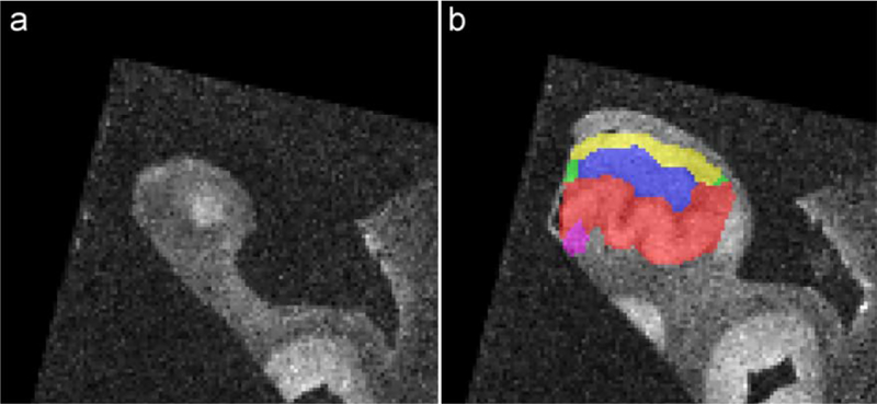 Figure 13.