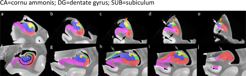 Figure 14.