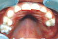 Fig. 12: