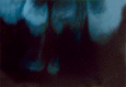 Fig. 4: