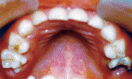 Fig. 2: