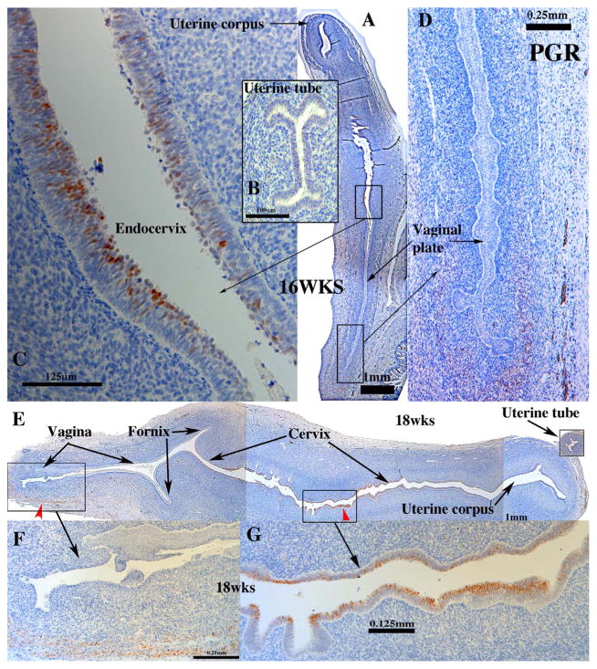 Fig. 14