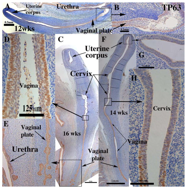 Fig. 11